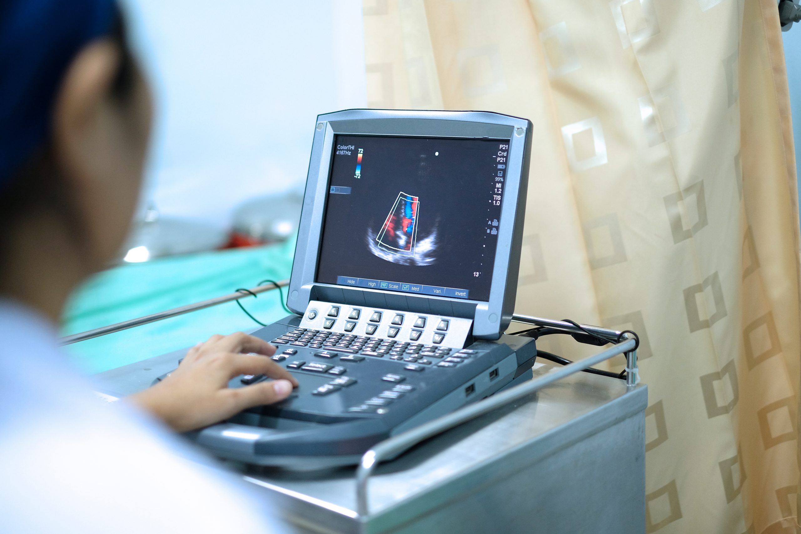 Physician making echocardiography for patient with heart disease